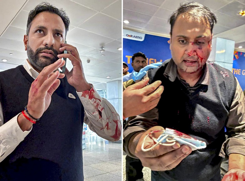 'Have not received complaint yet': Delhi Police on assault by off-duty Air India Express pilot